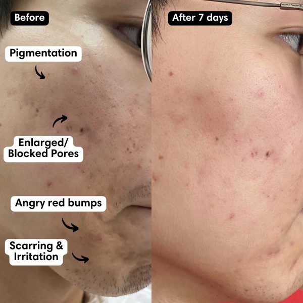 Hot Stone Brightening Mask Online Sale - Image 3